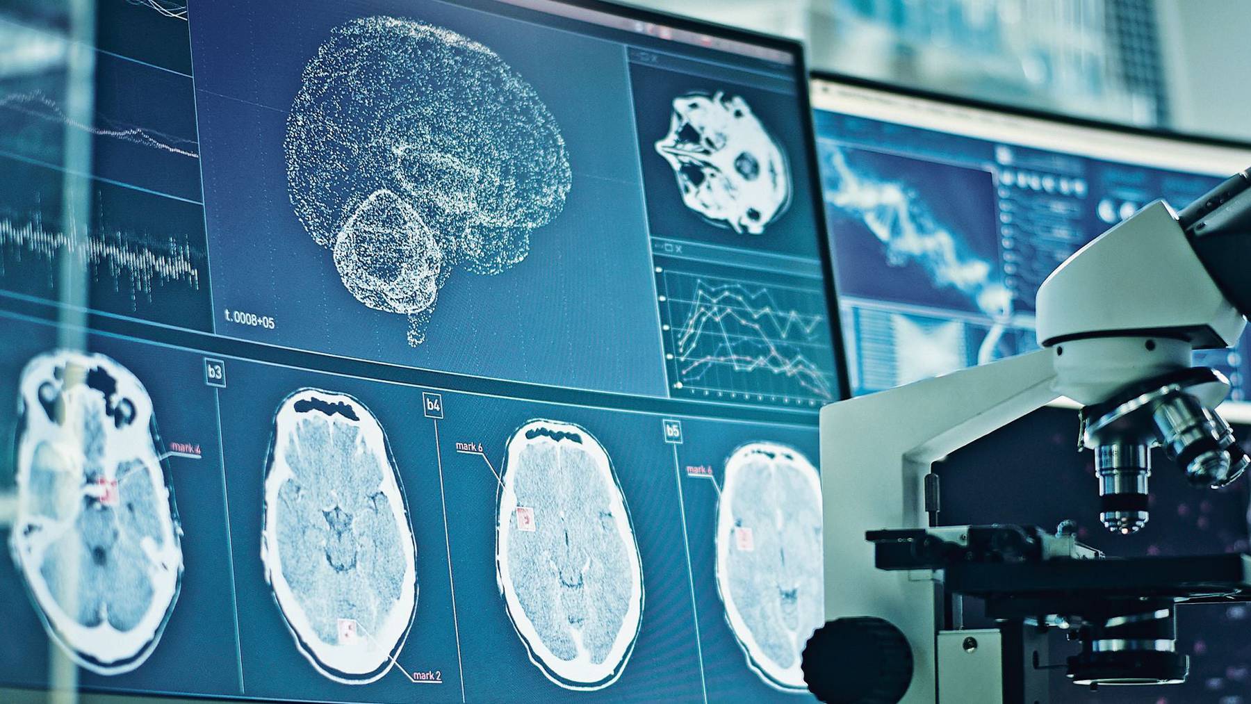 Neuro_Covid_Getty